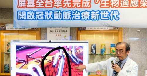 屏基率先全台完成「生物適應架」植入！三個月內已累積完成24例